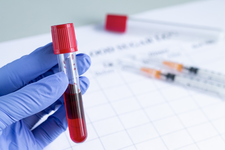 How Long Can Cord Blood Be Stored And Still Be Effective?